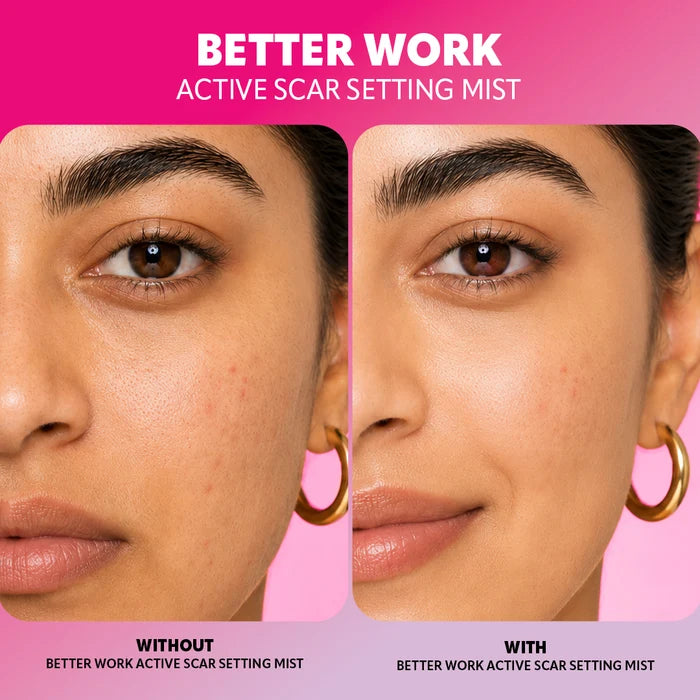 Trouble Maker Better Work Active Scar Setting Mist 4pc Set + 1 Full Size Product Worth 25% Value Free