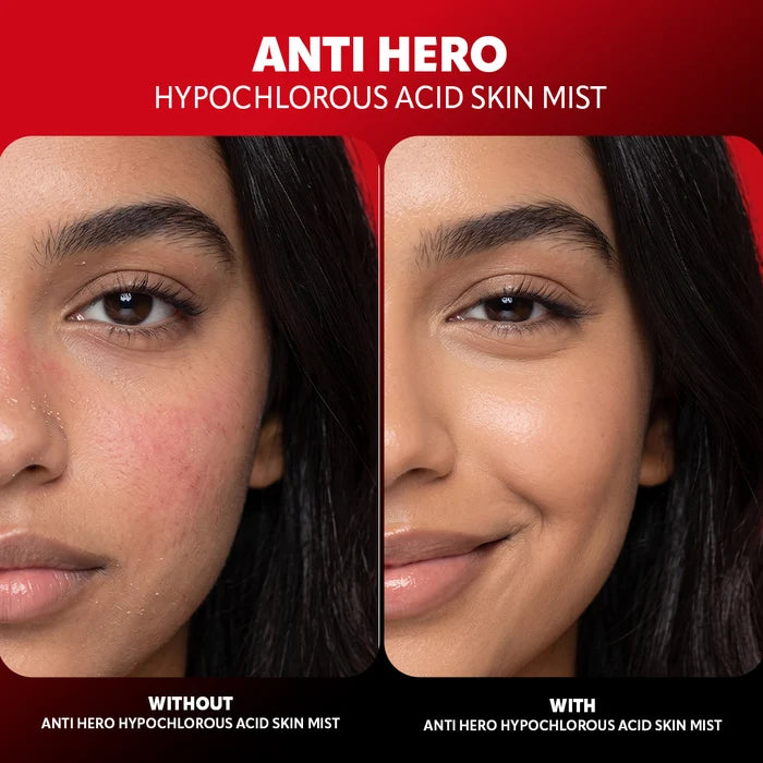 Trouble Maker Anti Hero Hypochlorous Acid Skin Mist 4pc Set + 1 Full Size Product Worth 25% Value Free